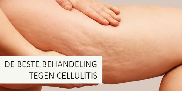 Germaine de Capuccini fit succes cellulitis