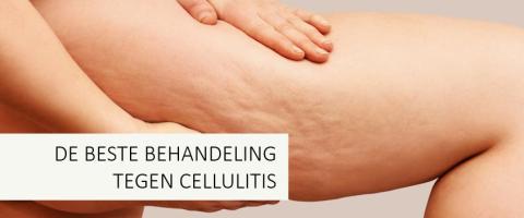 Germaine de Capuccini fit succes cellulitis